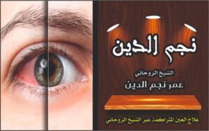 علاج العين المترامنة عبر الشيخ الروحاني