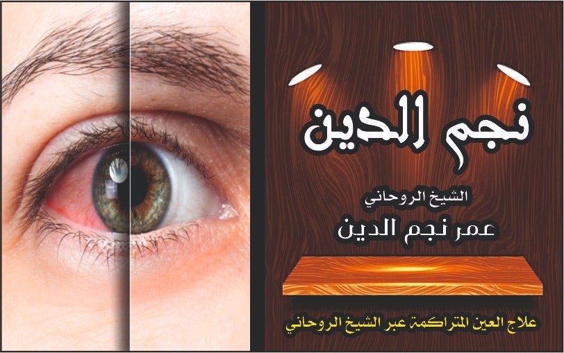 علاج العين المترامنة عبر الشيخ الروحاني